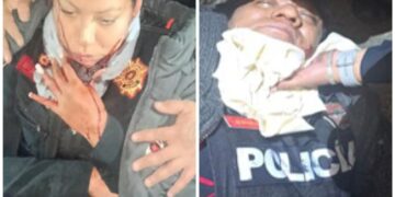 Policía herida en Jardines del Pedregal; hay un detenido